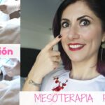 Transformación facial con mesoterapia virtual: Antes y después